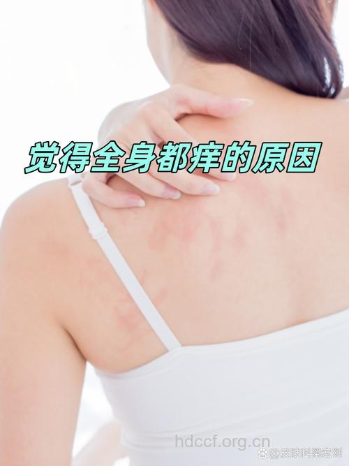 情绪紧张让皮肤发痒
