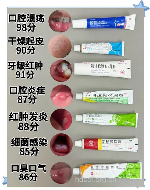 什么药物会引发口腔溃疡？