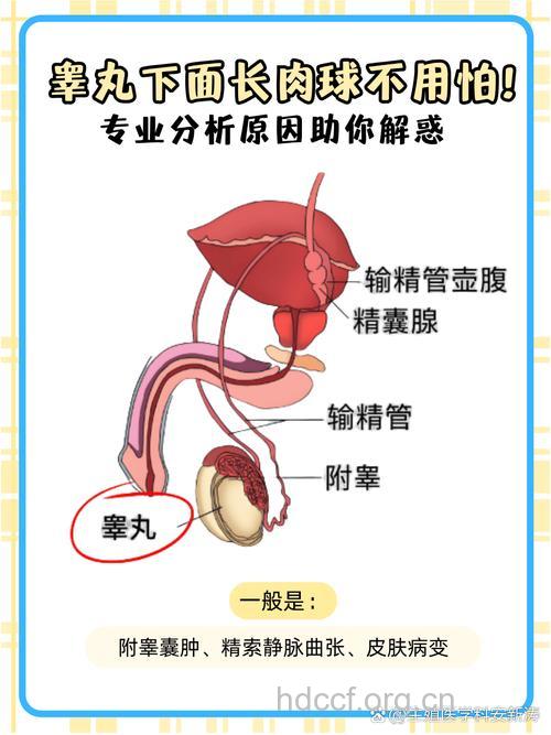 男性无睾症可分为哪几类？