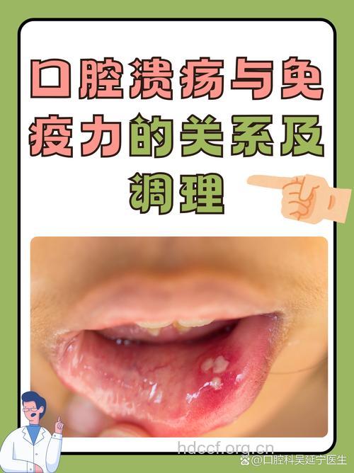 口腔溃疡与身体免疫力关系