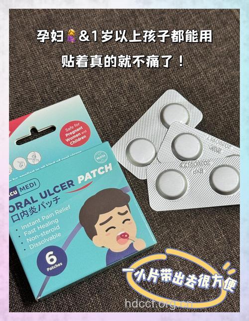 口腔溃疡竟然也可以用足贴