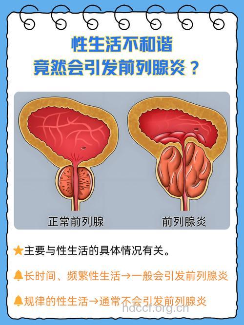 小小前列腺引起的不育