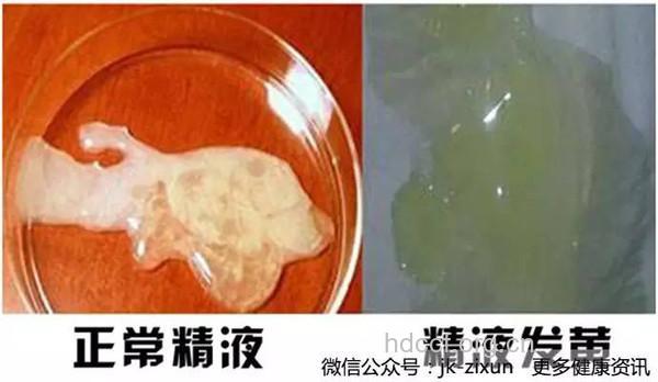 精液是男人特有的“精华”