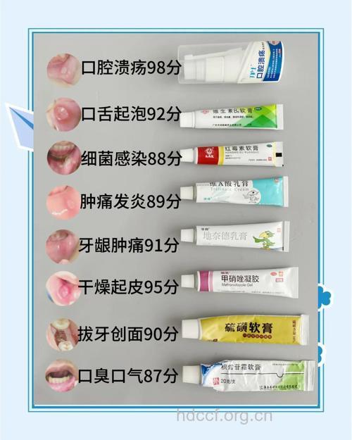 治疗口腔溃疡应用什么药