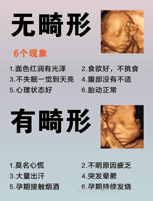 奇:不育竟存在遗传变异