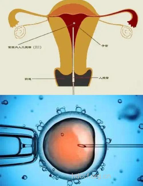 治男性不育的新突破-人造精子
