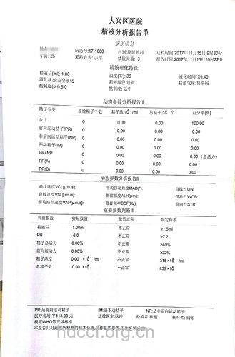 男性精液质量下降　染色体缺失“猛男”不育