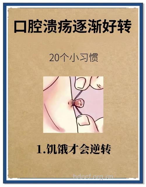 如何摆脱口腔溃疡呢