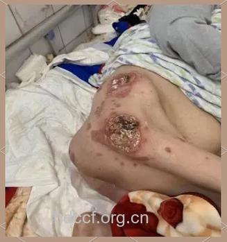 一个真实的艾滋病家庭