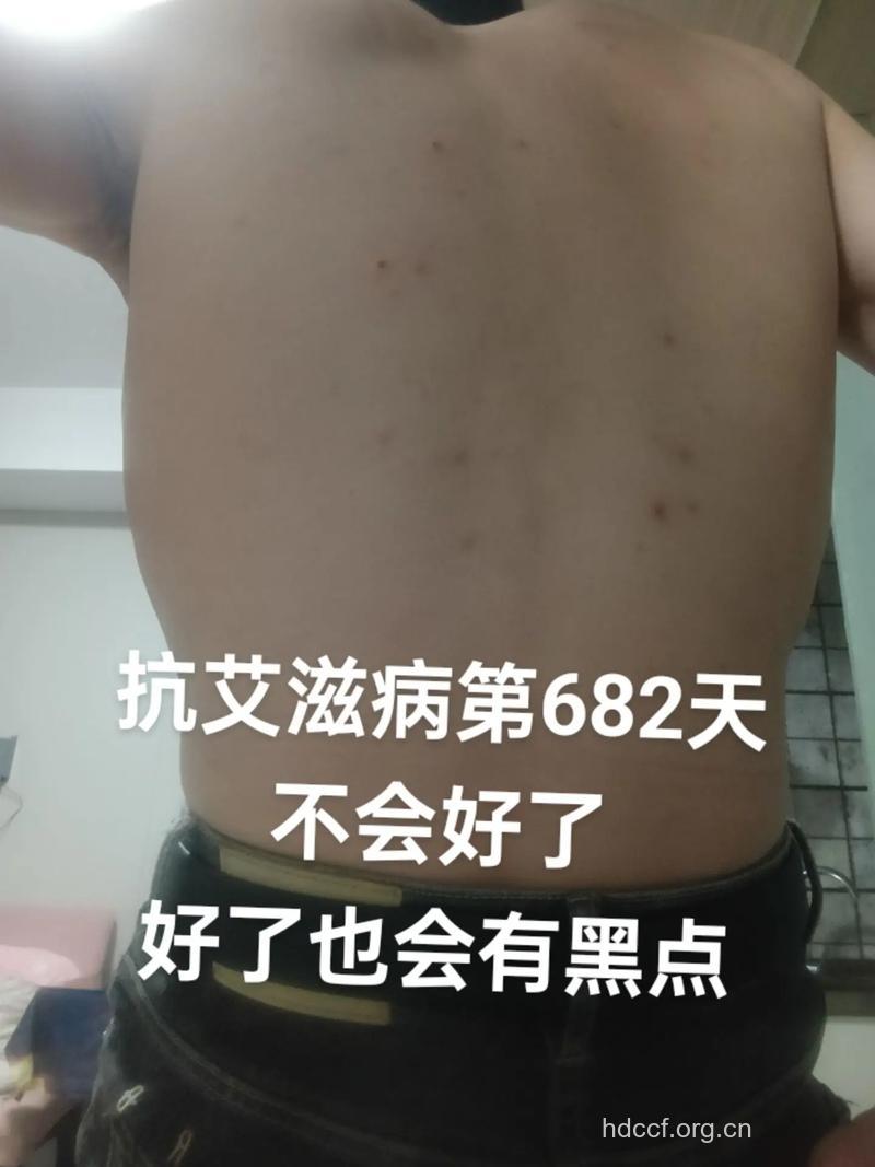 “被艾滋”背后的真问题