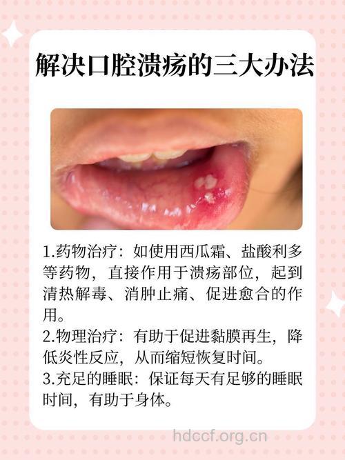 口腔溃疡有哪些物理疗法