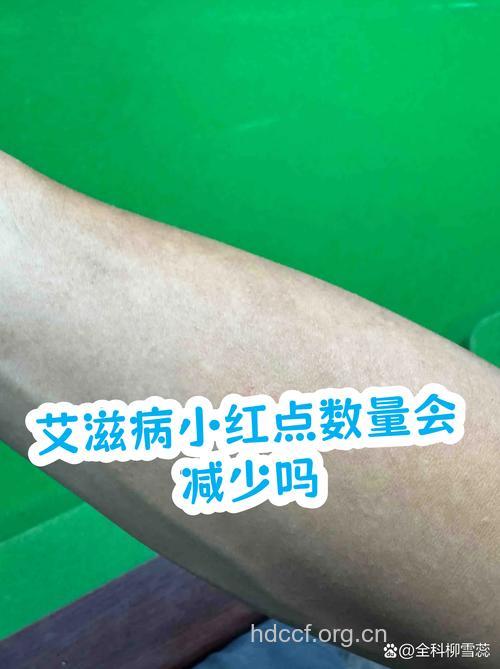 临产孕妇被查可能染艾滋病 婴儿是否感染仍未知