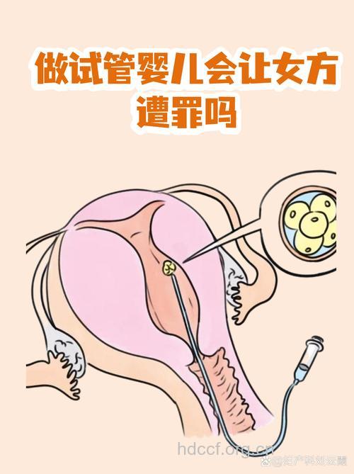 女方排卵困难 做试管婴儿的条件