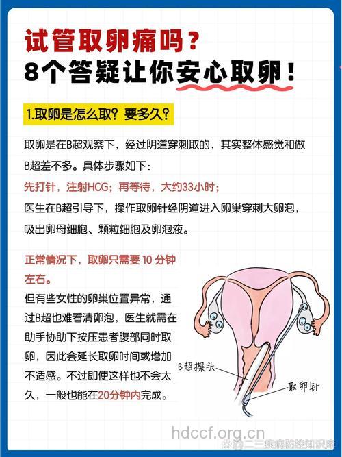 试管婴儿取卵会很痛吗