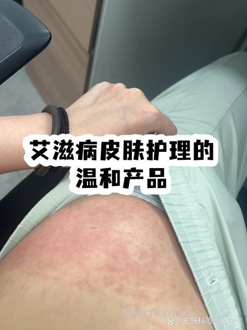 哪里是艾滋感染者飞翔的地方