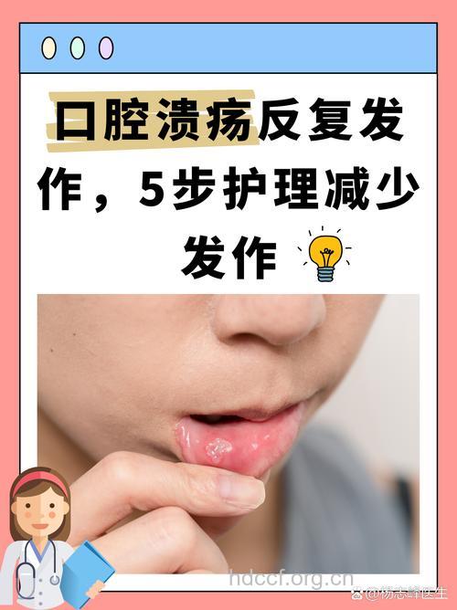 找对口腔溃疡原因进行治疗