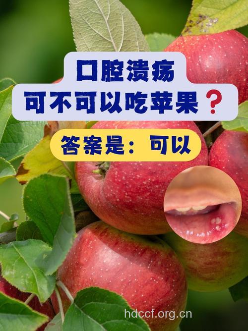 苹果柿子治疗口腔溃疡