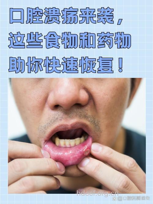 秋冬六种食物治疗口腔溃疡
