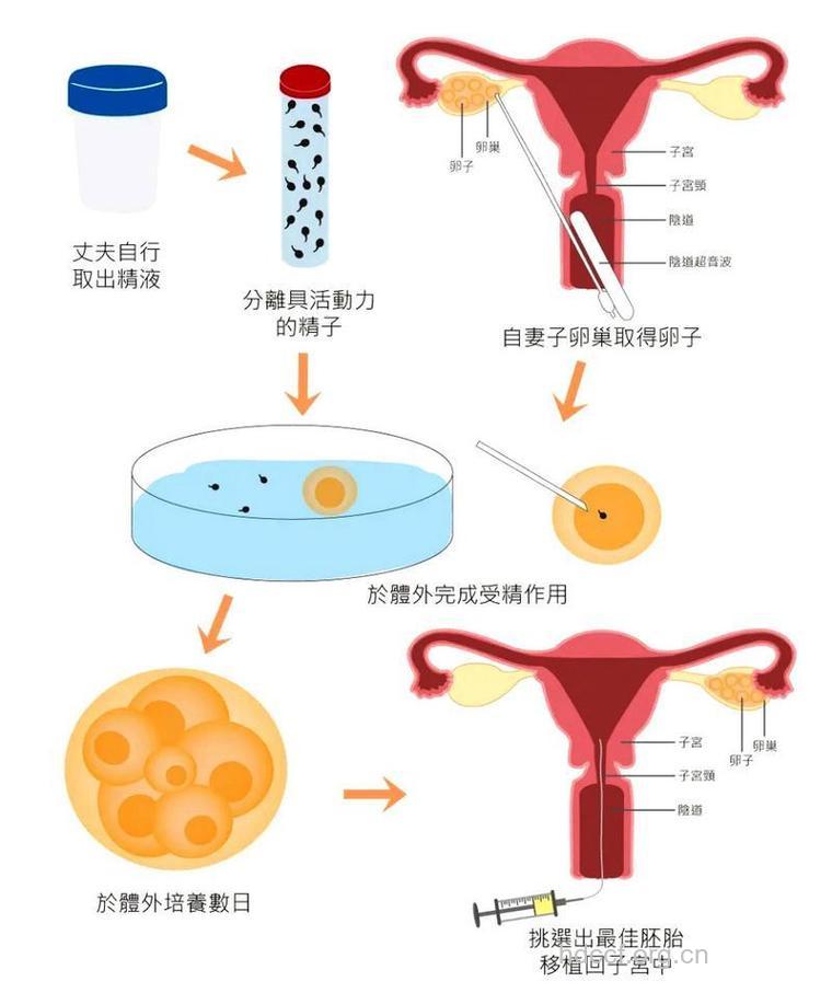 试管婴儿技术的原理