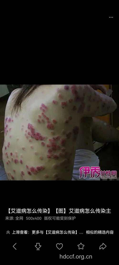 为什么我没见过艾滋病人？