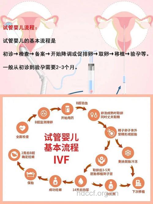 试管婴儿具体怎么取卵