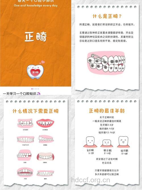 成人口腔正畸有哪些显著特点