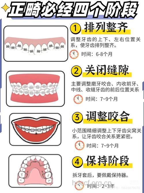 成人口腔正畸到底晚不晚