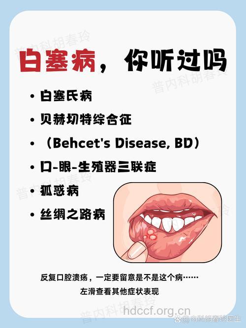 反复口腔溃疡原因是白塞病