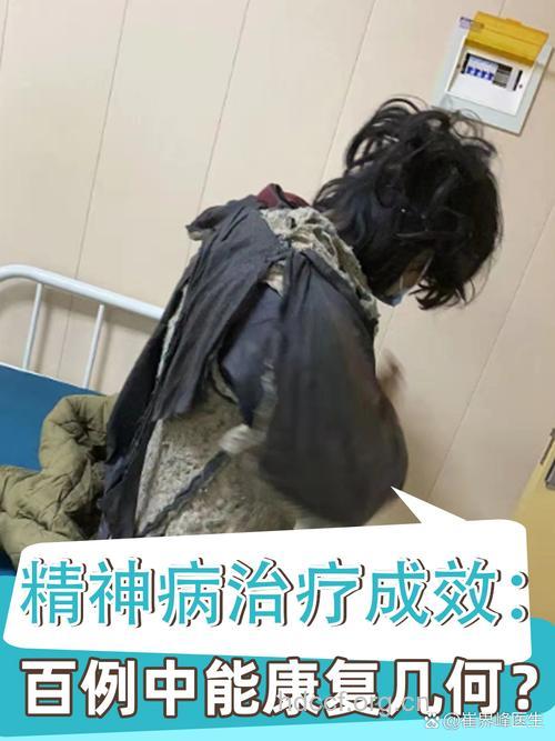 精神病复发有“蛛丝马迹”
