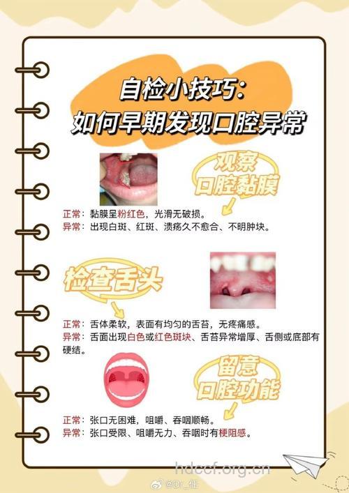 警惕口腔溃疡癌变