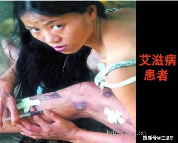 卖淫吸毒女的悲惨艾滋路