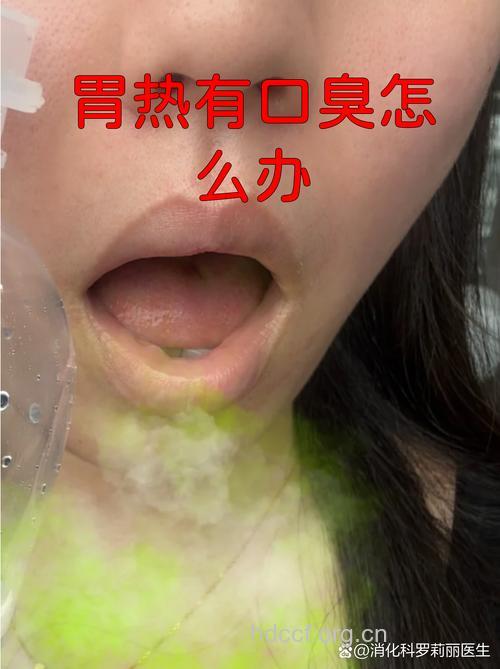 胃热口臭有哪些症状表现
