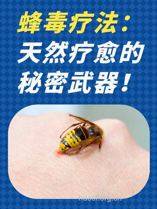 艾滋病能用蜂毒治疗吗？