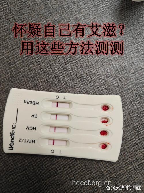 这3种途径可以检测艾滋病