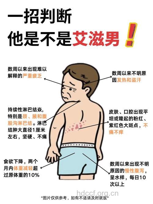 如何判断自己是否患上艾滋病