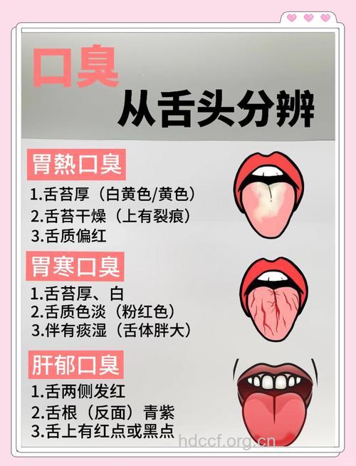 日常口臭的几个症状类型