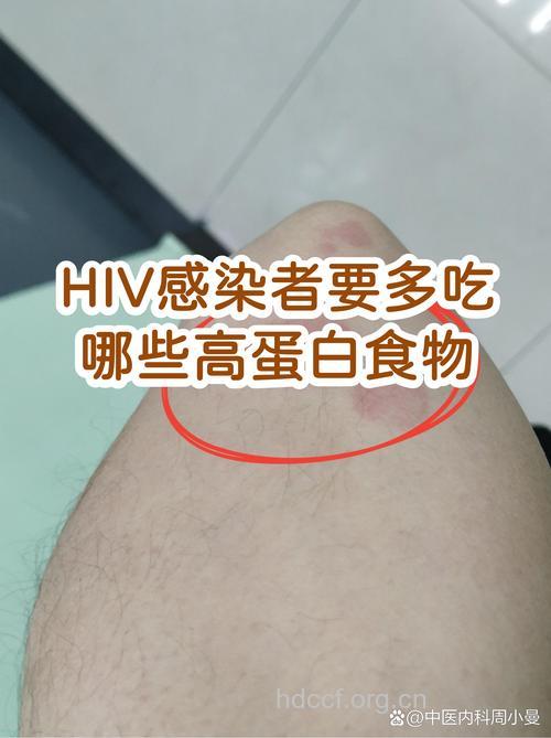 对艾滋病有益的高蛋白质食物
