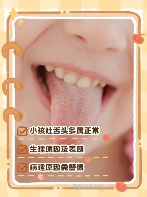 宝宝口臭的基本症状有哪些