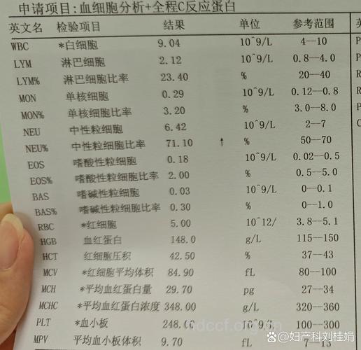 血常规检查能够查出艾滋病吗
