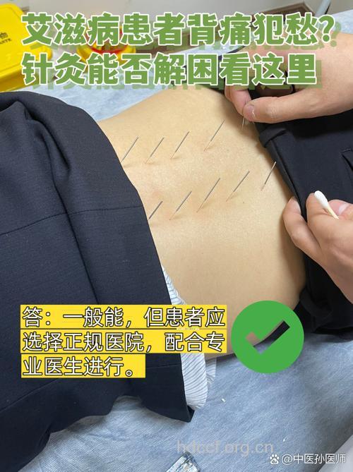 治疗艾滋病 且看中医针灸法