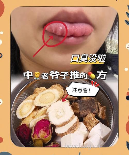 治疗上火口臭三偏方