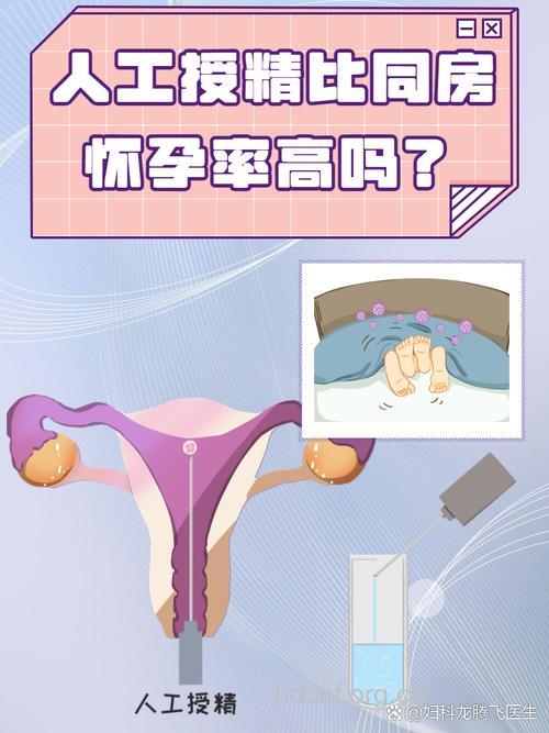 人工授精:自然流产频率高