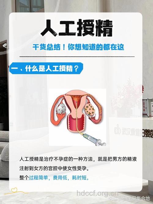 人工受精并非不孕首选