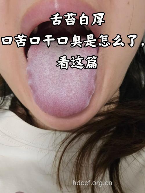 口臭常见的症状表现