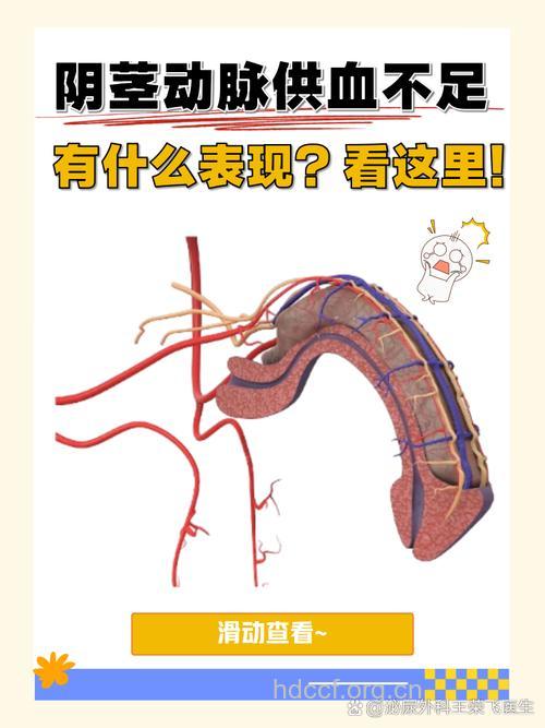 血管外科技术怎么治疗阳痿方法
