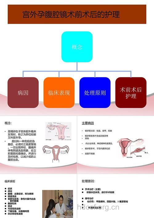 宫外孕腹腔镜手术后护理