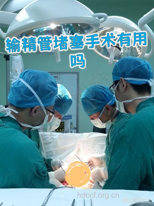 输精管造影术——排查输精管道堵塞