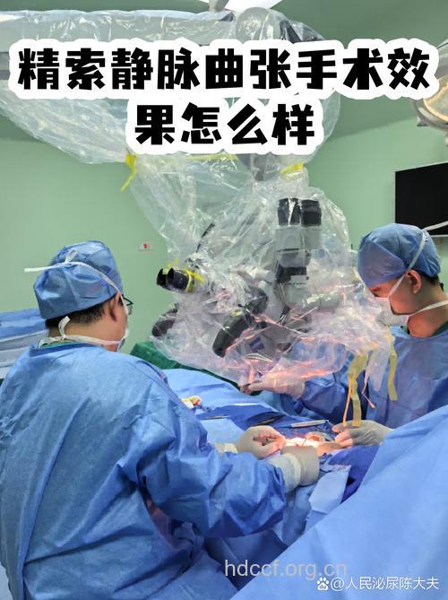治疗精索静脉曲张,首选腹腔镜