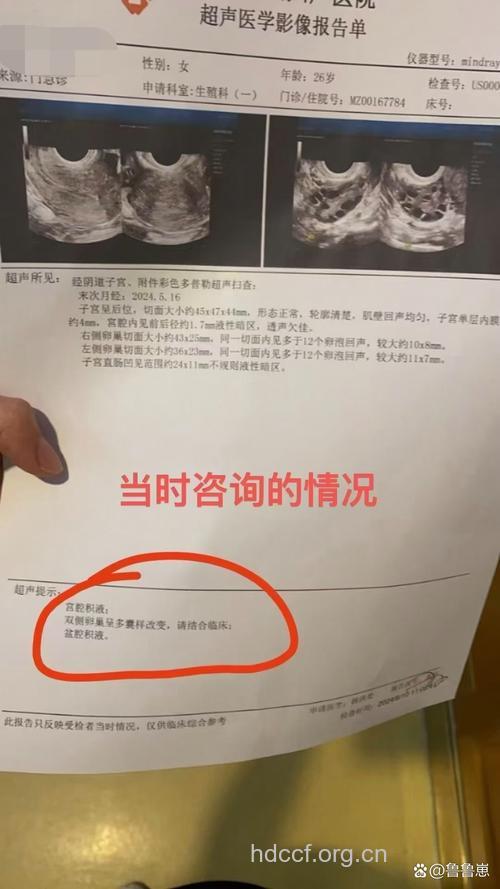 不孕病因多种，微创诊疗仅为“单项冠军”