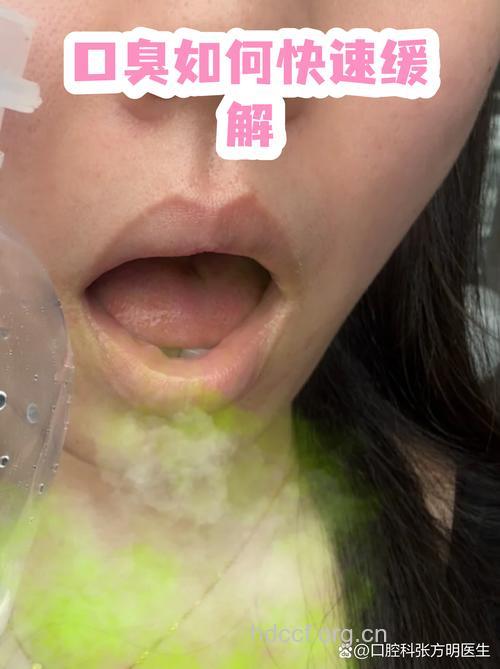 口臭要多吃芹菜认真刷牙